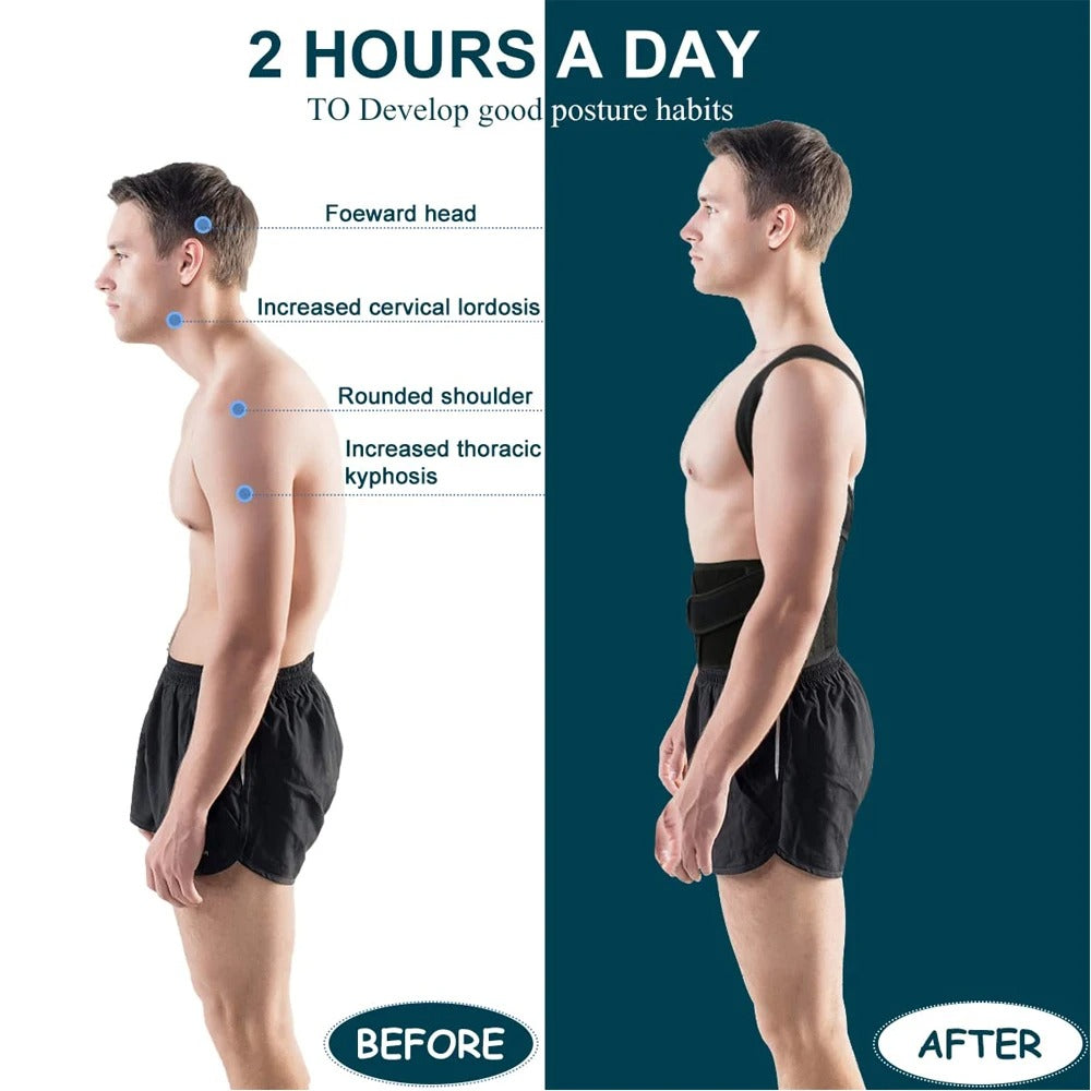Posture corrector