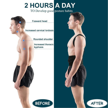 Posture corrector